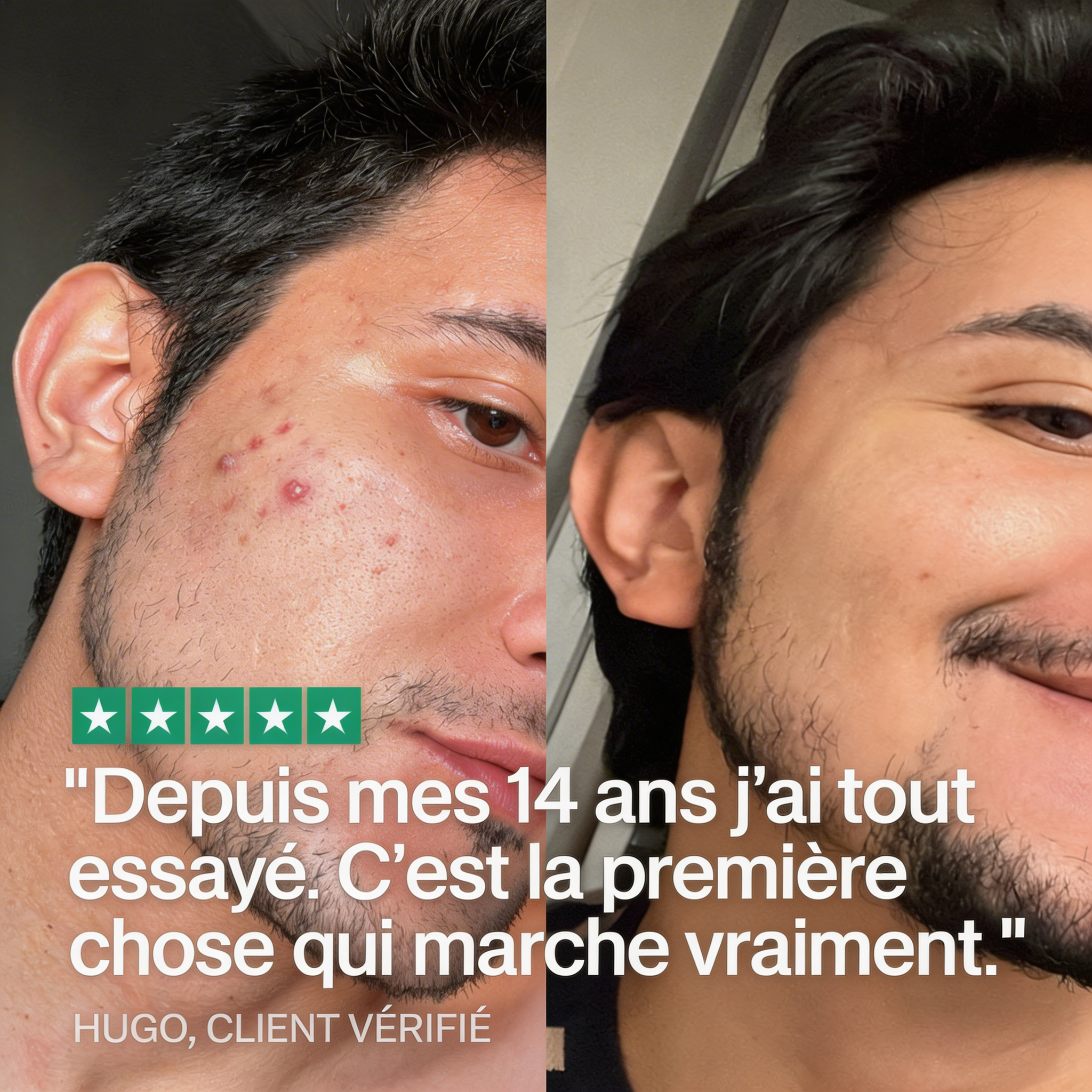 Derma