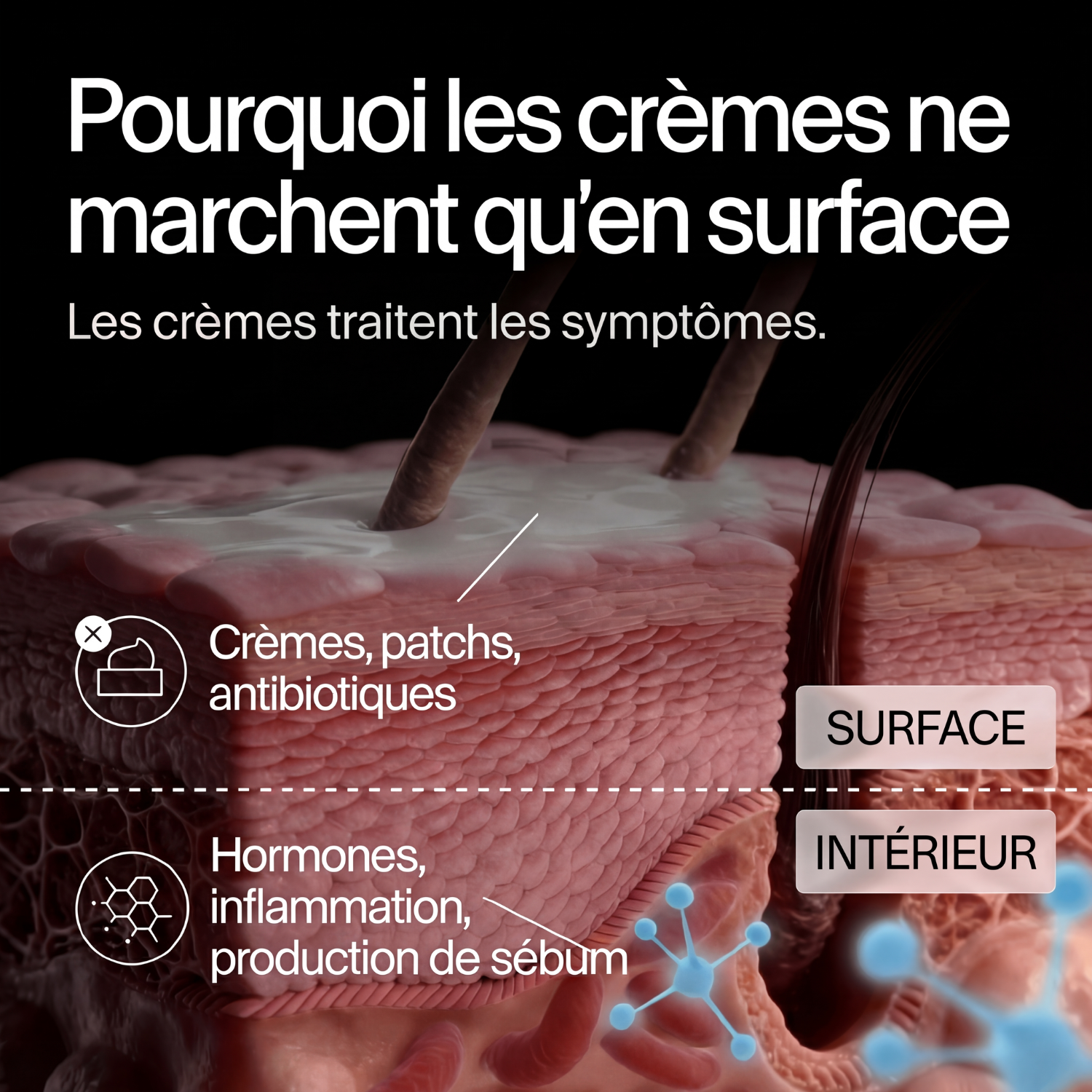 Élimine l'acné, de l'intérieur. Clera