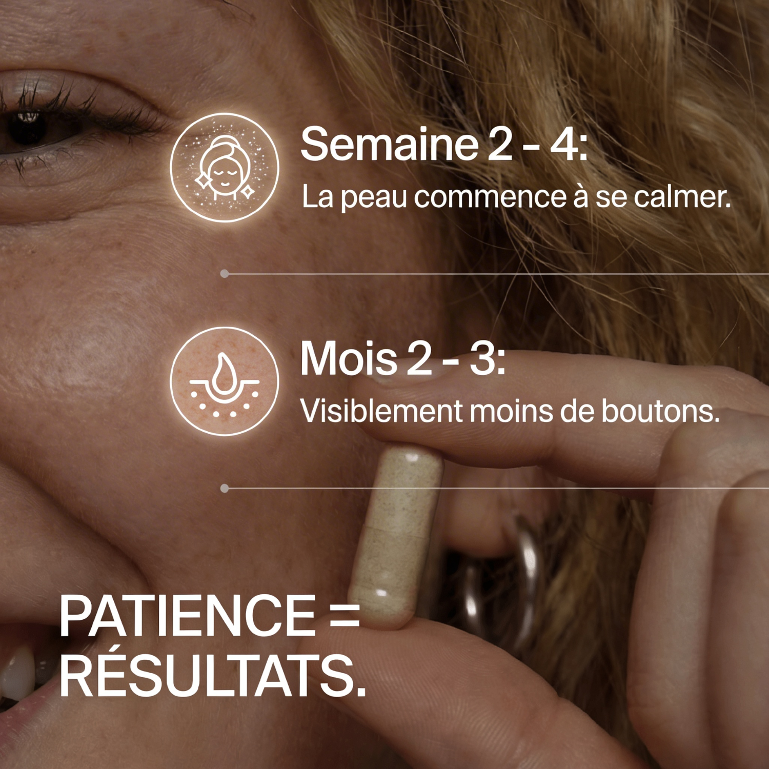 Élimine l'acné, de l'intérieur. Clera